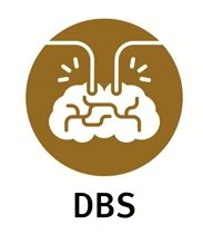 DBS.jpg