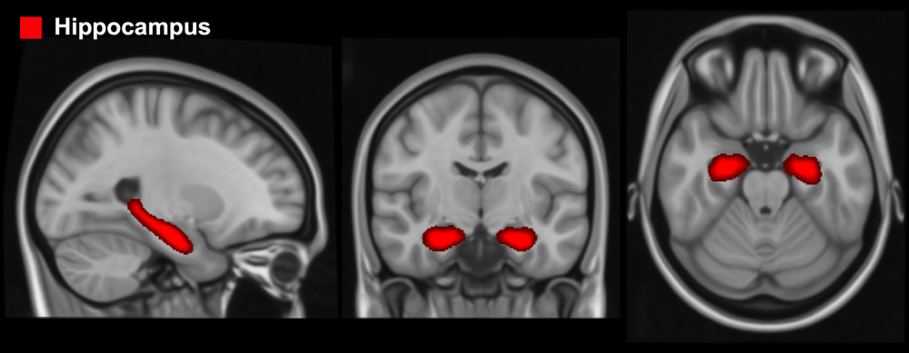 hippocampus.tif
