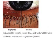 Ria Snoek_oog
